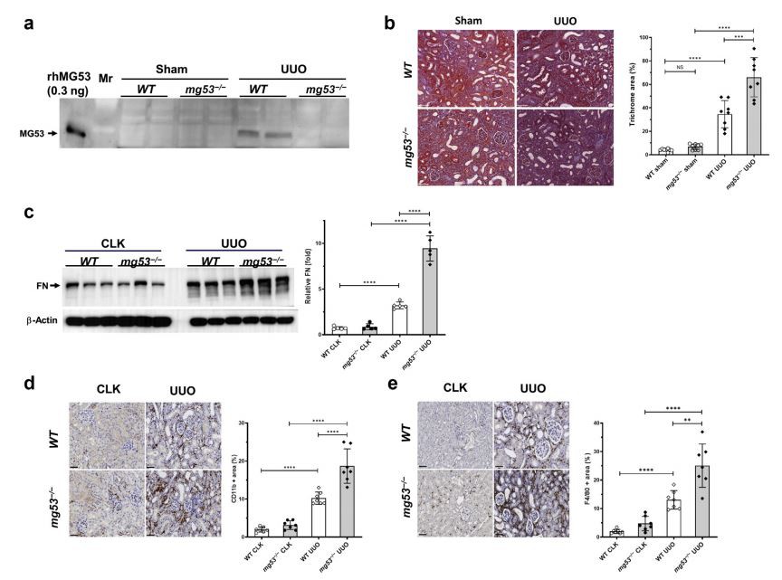 Loss of MG53 exacerbates kidney fibrosis and immune cell accumulation after unilateral ureteric obstruction (UUO). (a