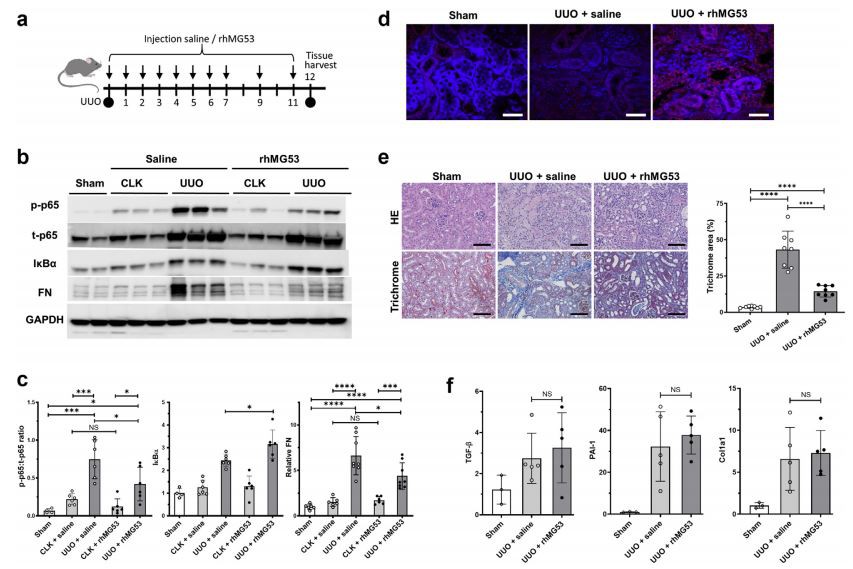 rhMG53 modulates p65 signaling to control kidney fibrosis. (a)