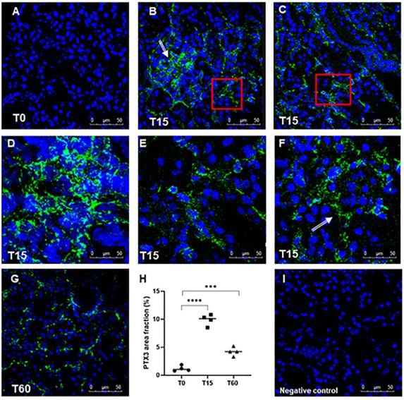 Figure 1. Analysis of PTX3 deposits in a swine model of I/R injury