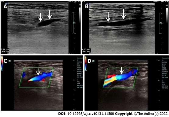 25% echinacoside 9% acteoside cistanche for kidney